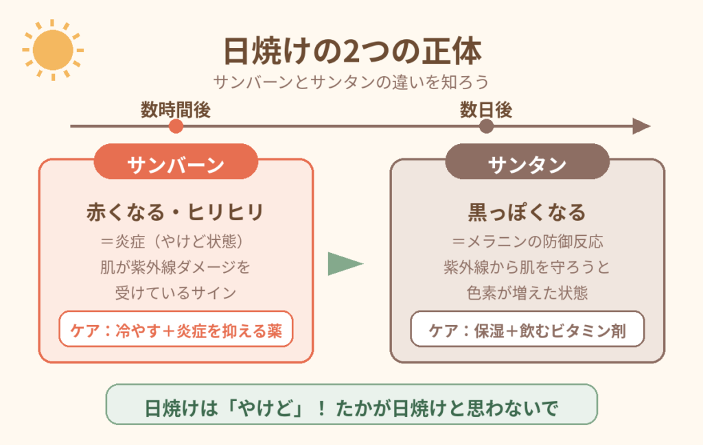サンバーンとサンタンの違いを表す図解